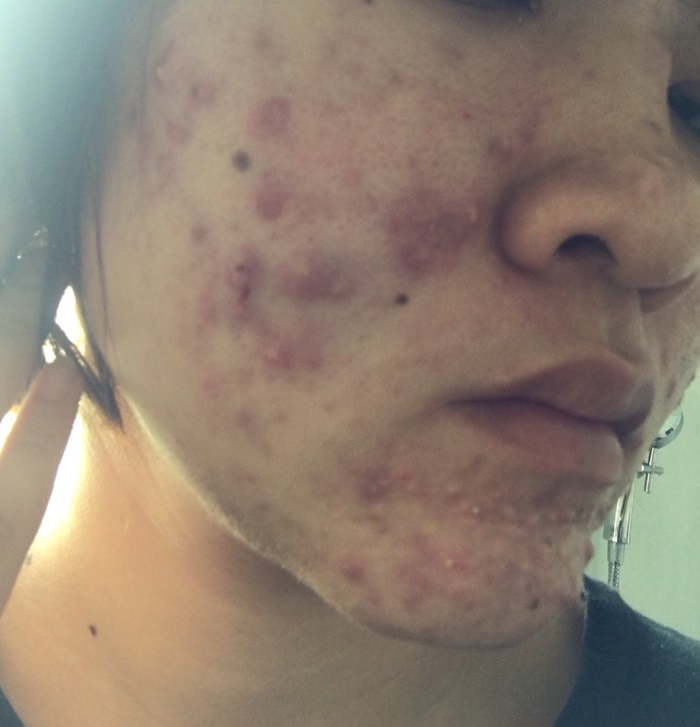 เมจิกสกิน