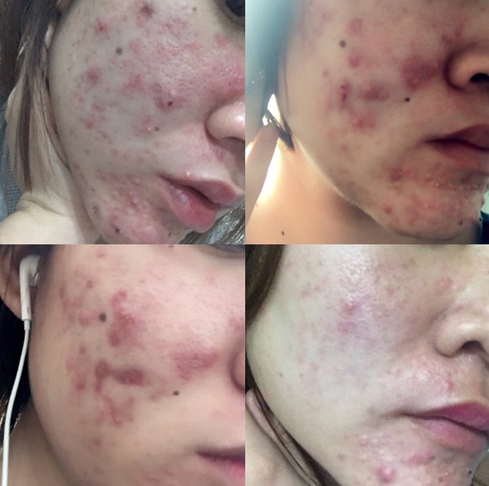 เมจิกสกิน