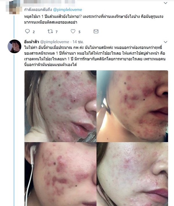 เมจิกสกิน