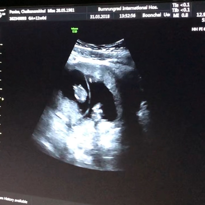 หนุ่ม คงกะพัน