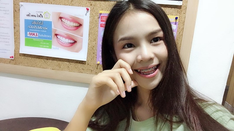 อาม ชุติมา