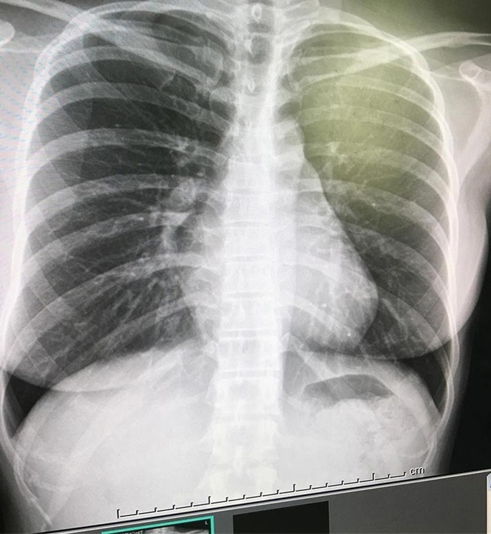 หนูเล็ก ก่อนบ่าย