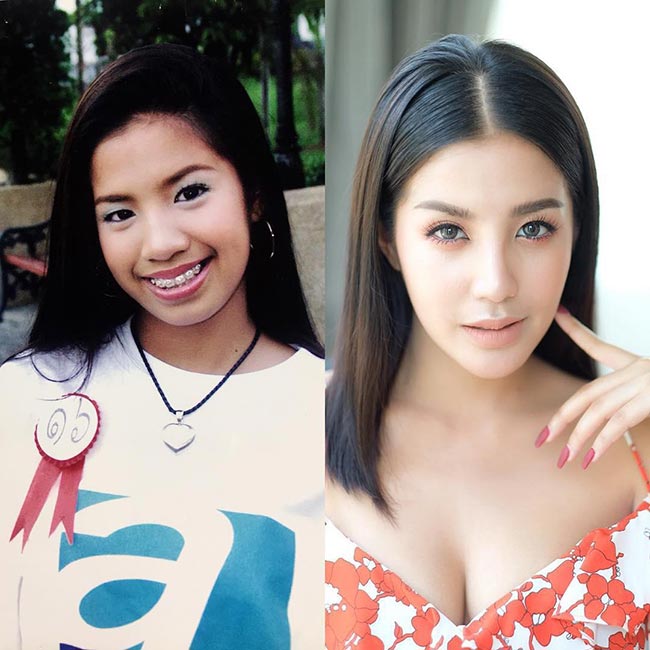 ดาราไม่ศัลยกรรม