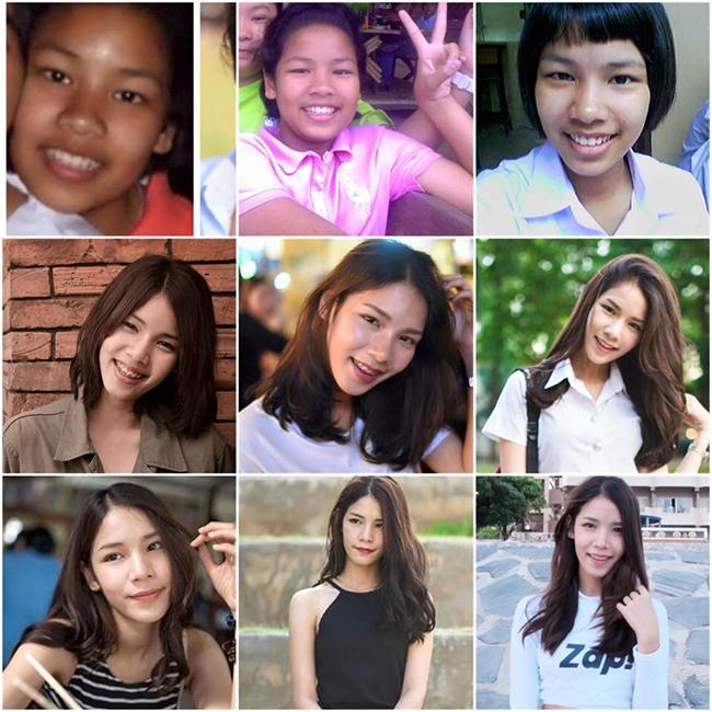 How Amm transform herself and her skin over time How Amm transform herself and her skin over time