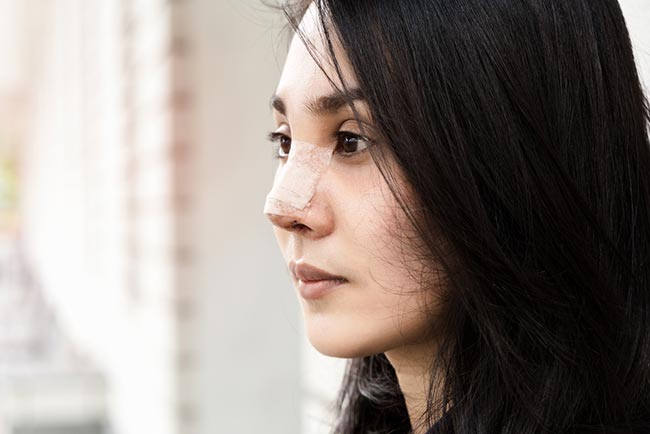 ศัลยกรรมจมูก