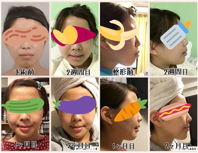 ศัลยกรรม