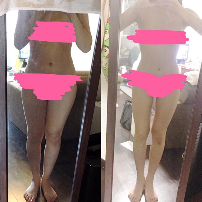 ศัลยกรรม