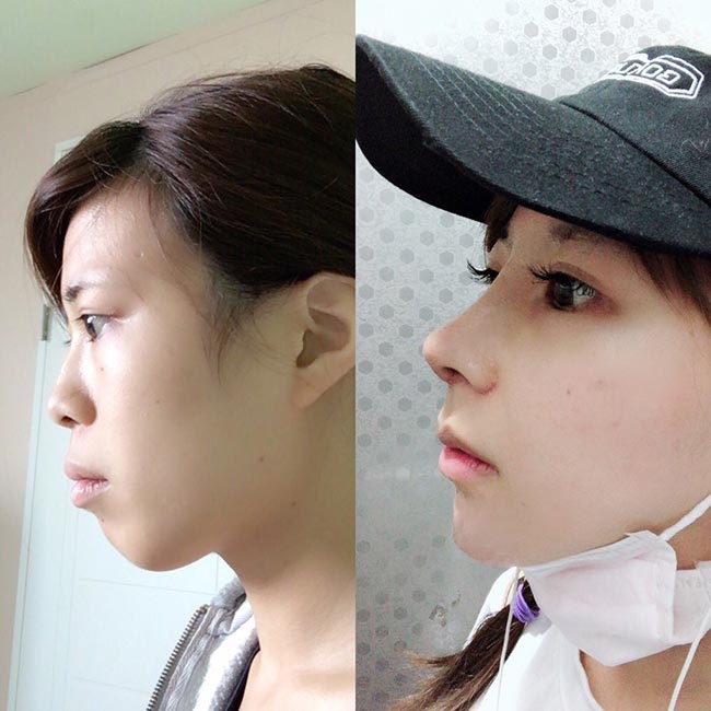 ศัลยกรรม