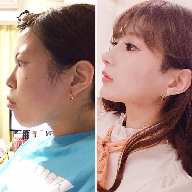 ศัลยกรรม