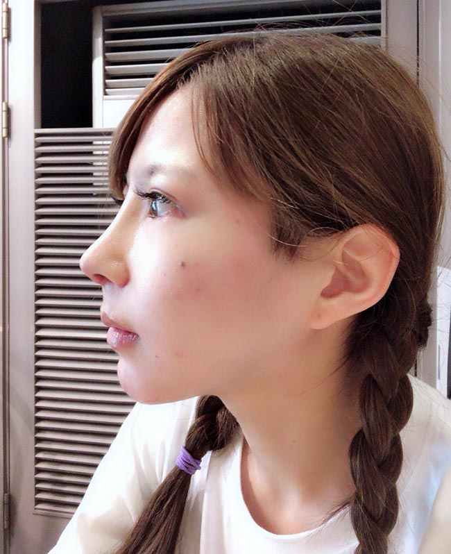 ศัลยกรรม