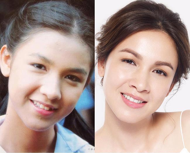 กบ สุวนันท์