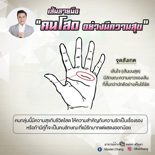 หมอช้าง