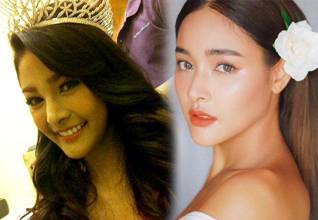 ดาราไม่ศัลยกรรม