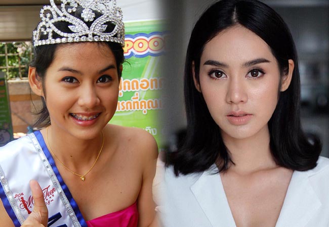 ดาราไม่ศัลยกรรม