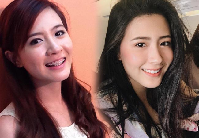 ดาราไม่ศัลยกรรม