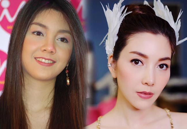 ดาราไม่ศัลยกรรม