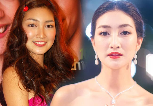 ดาราไม่ศัลยกรรม