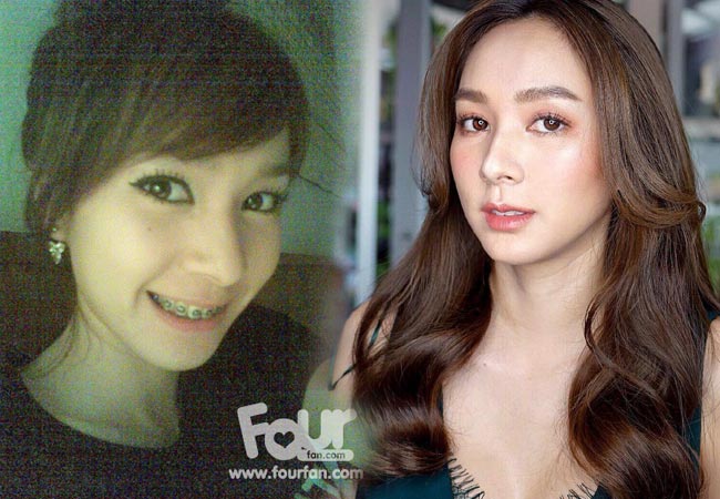 ดาราไม่ศัลยกรรม