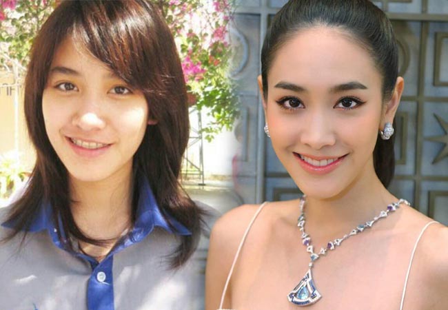 ดาราไม่ศัลยกรรม