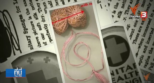 ผ้าอนามัยแต่ละประเทศในสมัยโบราณ