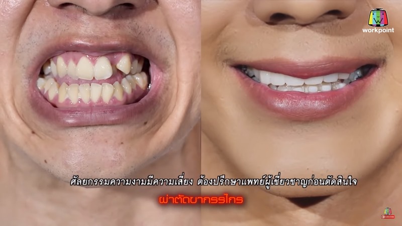 เอก โสภณ Let Me In Thailand