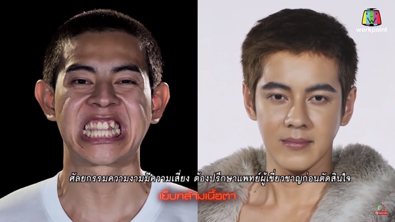 เอก โสภณ Let Me In Thailand