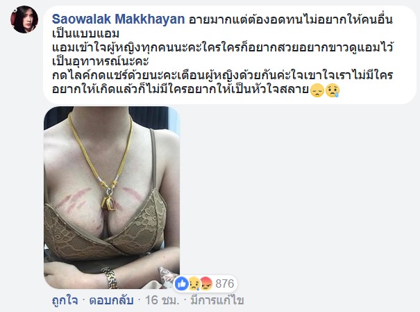 เตือนภัยครีมผิวขาว