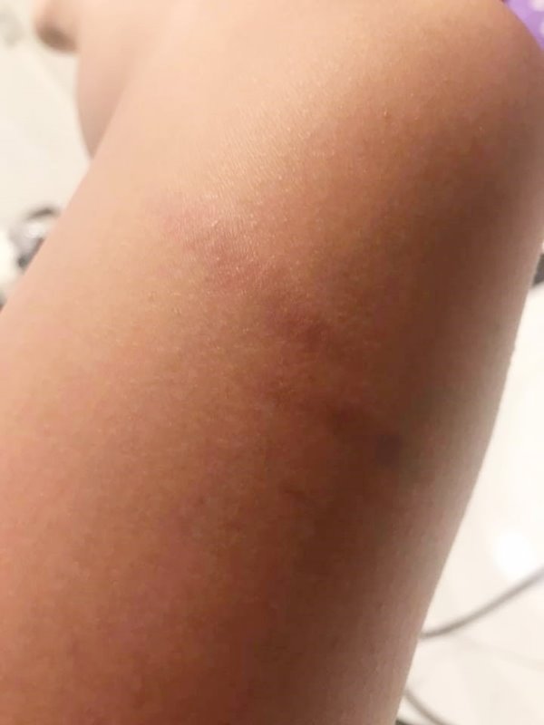 เตือนภัยครีมผิวขาว