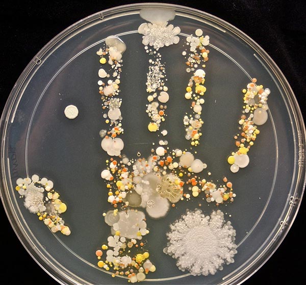 เชื้อโรค