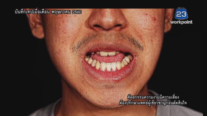 Let Me In ซีซั่น 3