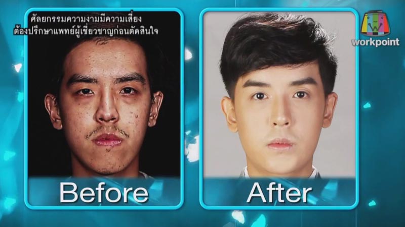 Let Me In ซีซั่น 3