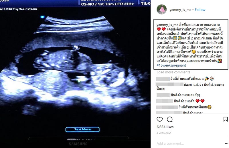 แยม ธมลพรรณ์ ท้อง