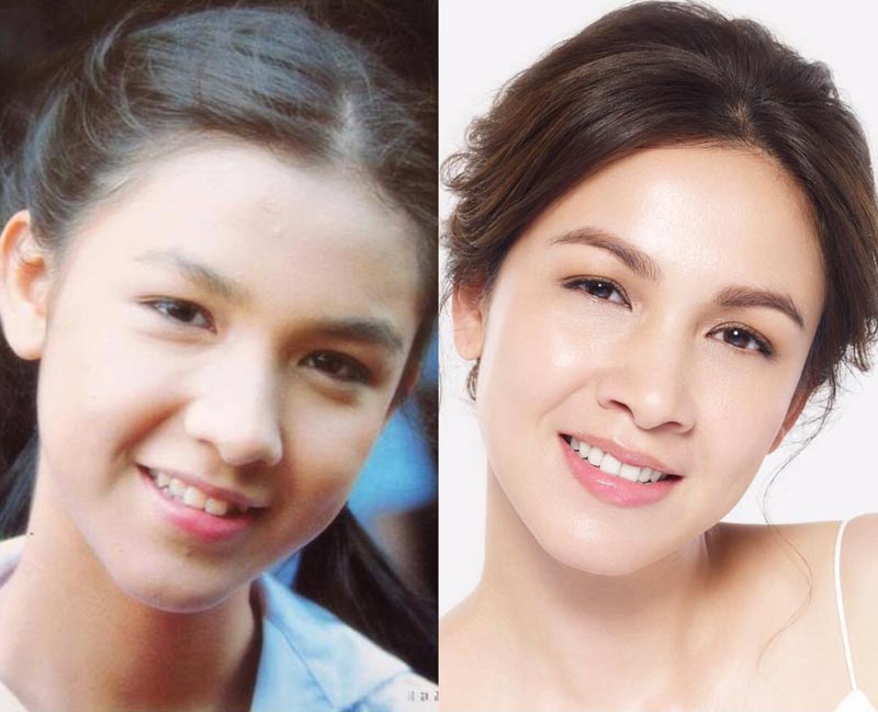 กบ สุวนันท์