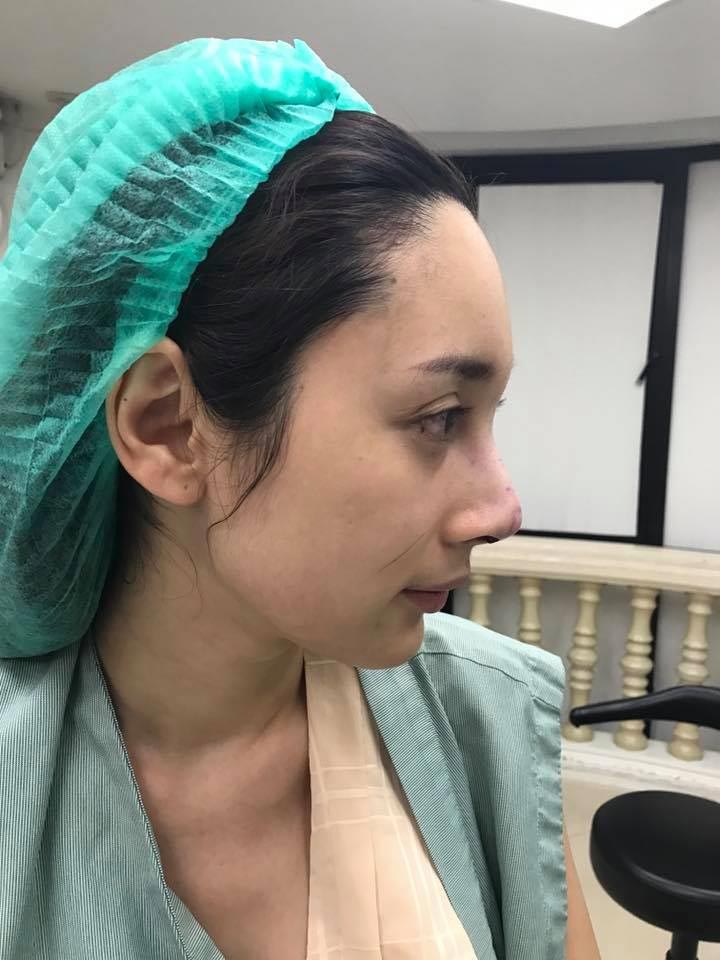 น้ำเพชร ฏีญาร์ภา ศัลยกรรม