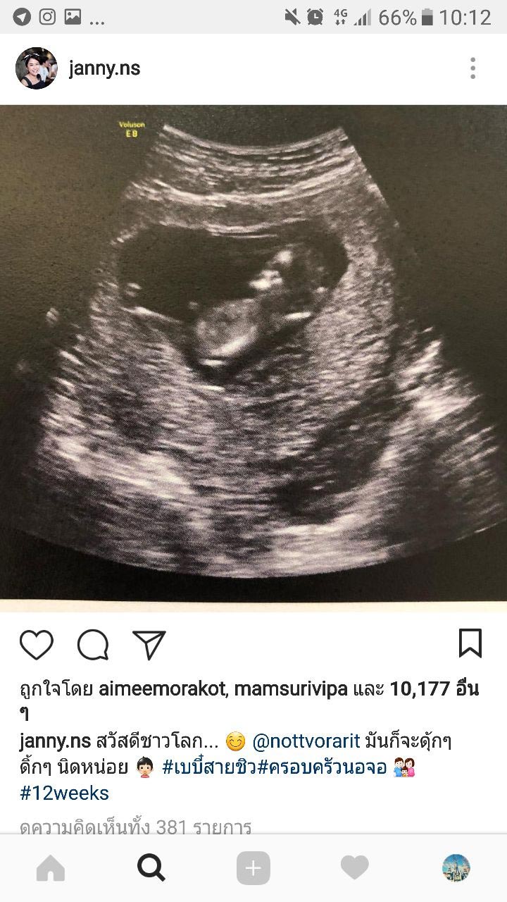 น็อต วรฤทธิ์