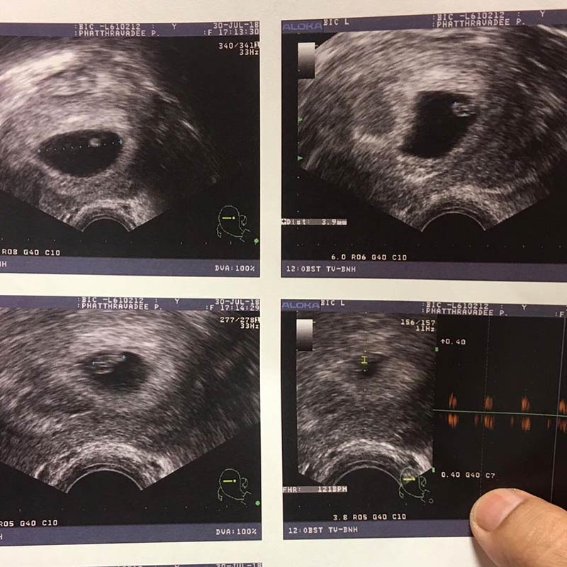 หนูเล็ก ก่อนบ่าย