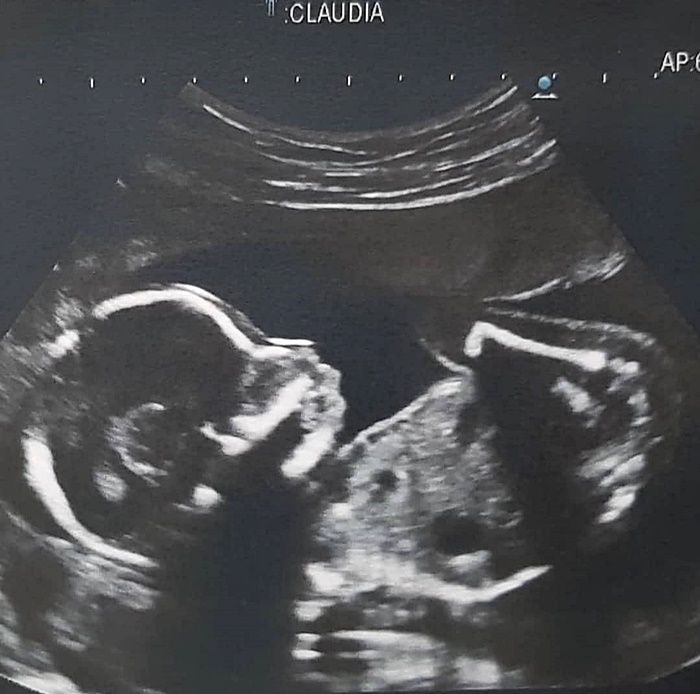 ดีเจต้นหอม 