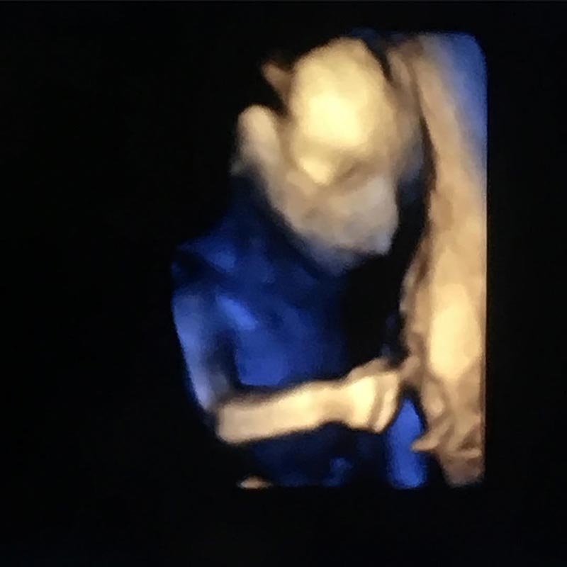 ชาคริต แย้มนาม