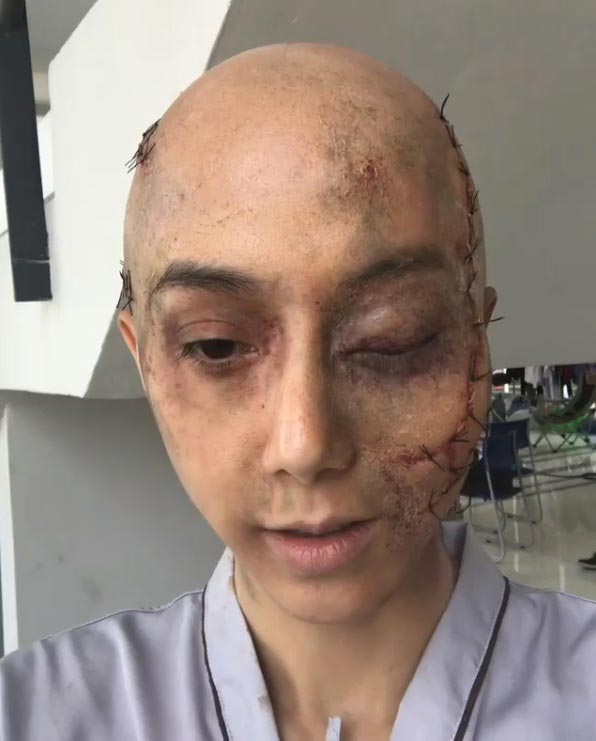 ไอซ์ อภิษฎา