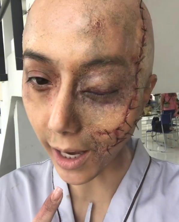 ไอซ์ อภิษฎา