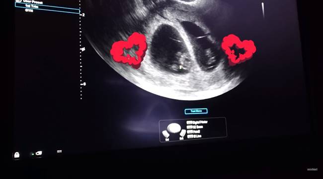 ป๊อก มาร์กี้ 