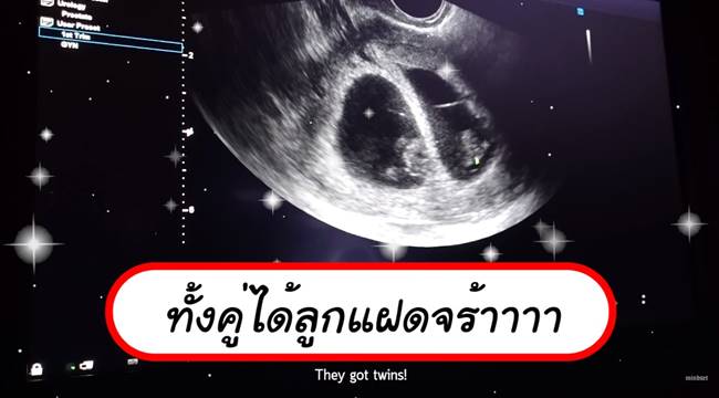 ป๊อก มาร์กี้ 