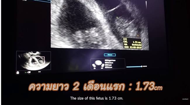 ป๊อก มาร์กี้ 