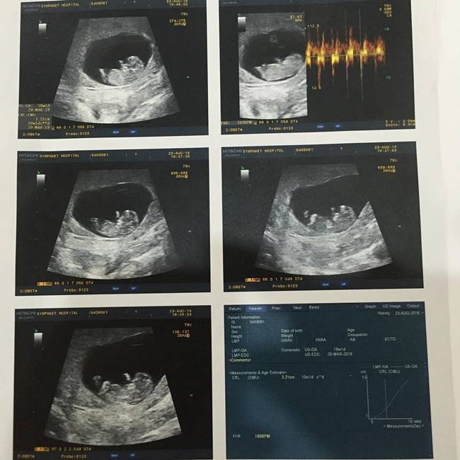 หนูเล็ก ก่อนบ่าย