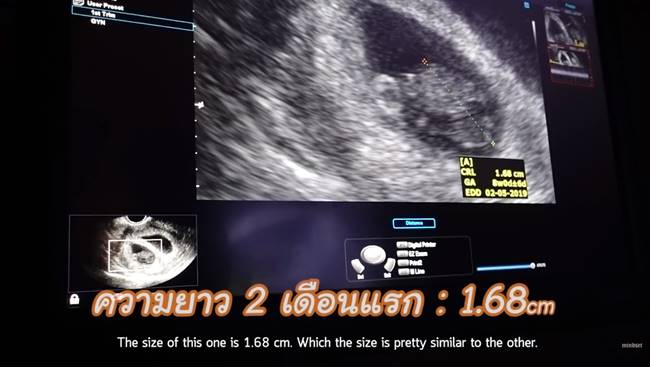 ป๊อก มาร์กี้ 