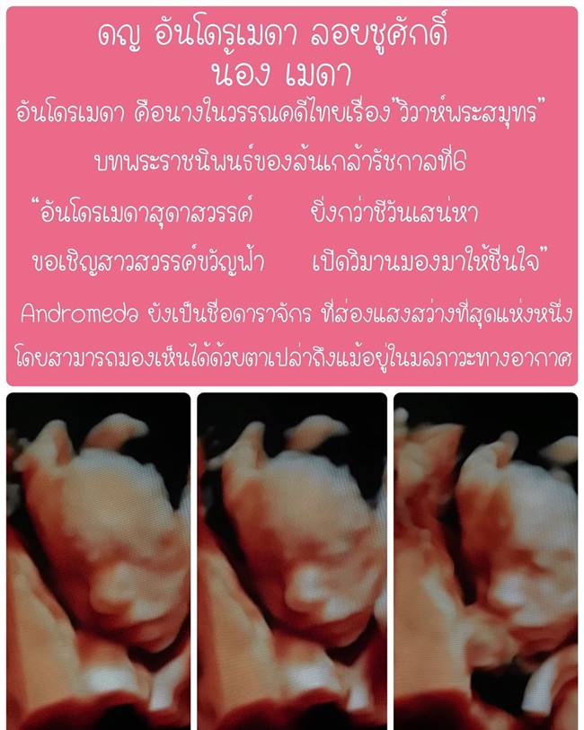 เจมส์ เรืองศักดิ์