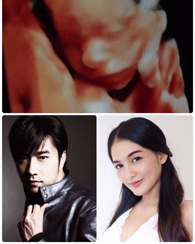 เจมส์ เรืองศักดิ์