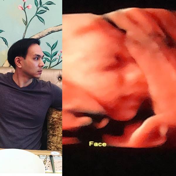 โบว์ สาวิตรี 