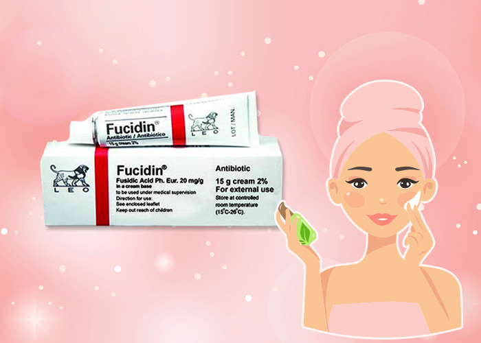 ครีมรักษาสิว