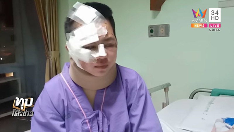 ตํารวจขับรถชน